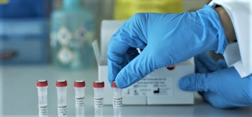 Fraude dans le marché Acquisition des tests Covid-19 : Le démenti du ministère Fraude dans le marché Acquisition des tests Covid-19 : Le démenti du ministère