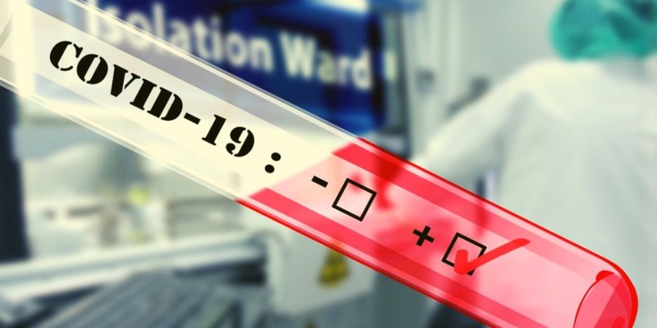 Compteur coronavirus : 3.254 nouveaux cas et 51 décès en 24H Compteur coronavirus : 3.254 nouveaux cas et 51 décès en 24H