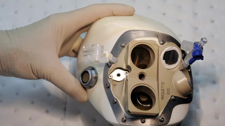 Transplantation : Vers une commercialisation des cœurs artificiels 
