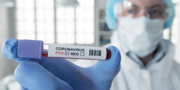 Compteur coronavirus : 594 cas testés positifs et plus de 3,7 millions de personnes vaccinées Compteur coronavirus : 594 cas testés positifs et plus de 3,7 millions de personnes vaccinées