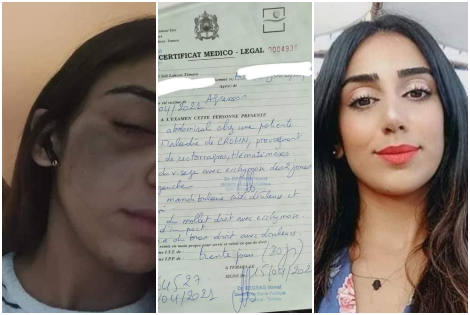 Une enseignante contractuelle accuse un policier de violence et de harcèlement, la DGSN réagit Une enseignante contractuelle accuse un policier de violence et de harcèlement, la DGSN réagit