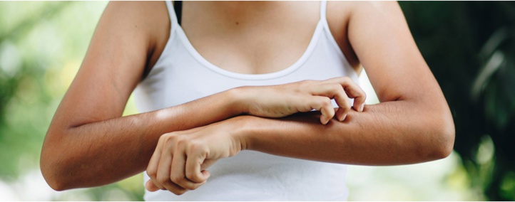 Huiles essentielles, répulsifs, bracelets... Comment se protéger contre les moustiques ? Huiles essentielles, répulsifs, bracelets... Comment se protéger contre les moustiques ?