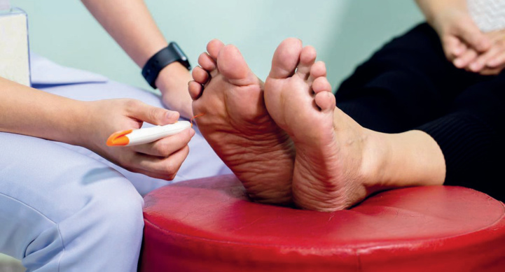 Le pied diabétique : De simples plaies difficilement traitables Le pied diabétique : De simples plaies difficilement traitables