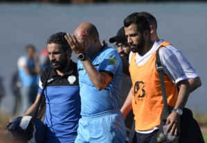 Le 2ème juge de touche touché par un projectile. Le 2ème juge de touche touché par un projectile.