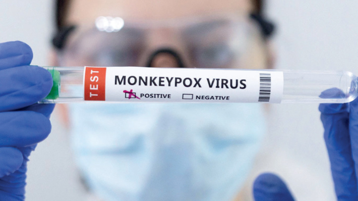 Variole du singe : Peut-on compter sur le vaccin classique pour éviter la contagion ?