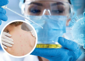 Virologie / Covid-19 : Zoom sur les leçons tirées de la riposte au VIH Virologie / Covid-19 : Zoom sur les leçons tirées de la riposte au VIH