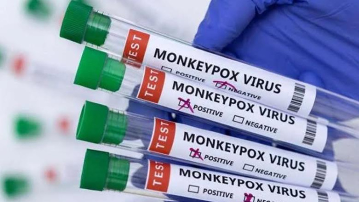 Variole du singe : Alerte maximale à l’OMS Variole du singe : Alerte maximale à l’OMS