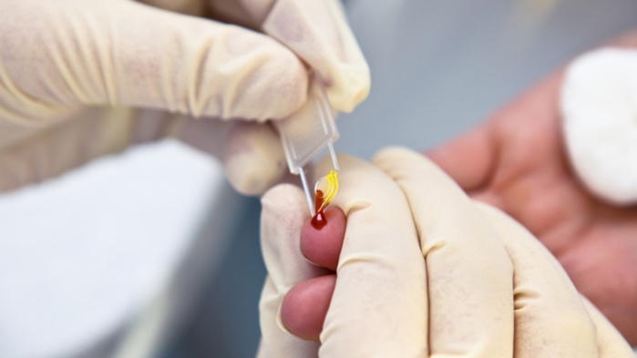 Santé : Le Maroc lance une campagne nationale de dépistage de l'hépatite C Santé : Le Maroc lance une campagne nationale de dépistage de l'hépatite C