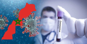 Covid-19: 79 nouveaux cas et 97 guérisons en 24H