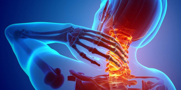 Entorse cervicale : quel traitement ?