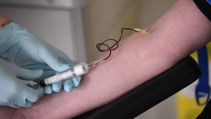 Santé : Un nouveau test pour détecter le cancer Santé : Un nouveau test pour détecter le cancer