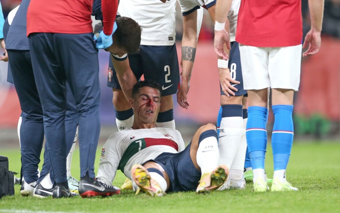 Ligue des Nations / Tchèque-Portugal : Ronaldo, le solide, c’est sûr, n’est pas en coton! Ligue des Nations / Tchèque-Portugal : Ronaldo, le solide, c’est sûr, n’est pas en coton!