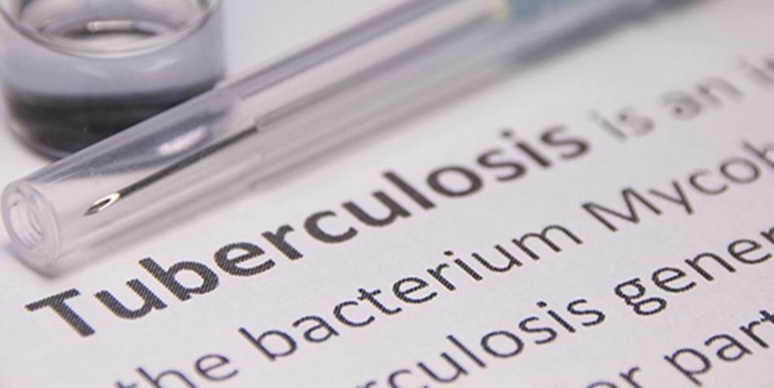 Casablanca : Un nouveau centre dédié au diagnostic de la tuberculose et maladies respiratoires Casablanca : Un nouveau centre dédié au diagnostic de la tuberculose et maladies respiratoires