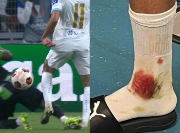 Europa League : Aguerd auteur du but de la victoire de West Ham Europa League : Aguerd auteur du but de la victoire de West Ham