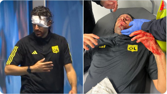 Ligue 1 / OM-OL:  Incidents graves, match non joué! Ligue 1 / OM-OL:  Incidents graves, match non joué!