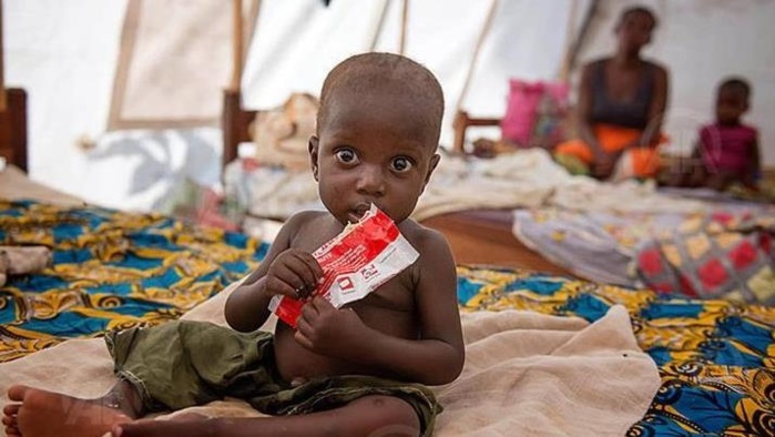Soudan : Un million d'enfants de moins de cinq ans souffriront de malnutrition aiguë Soudan : Un million d'enfants de moins de cinq ans souffriront de malnutrition aiguë