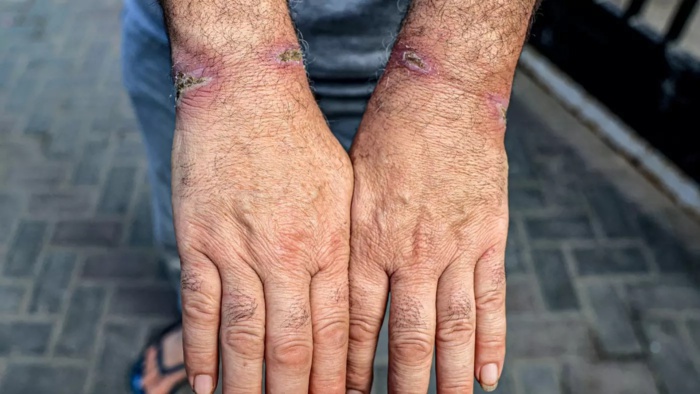 Un médecin israélien dénonce les conditions dans un centre de détention
