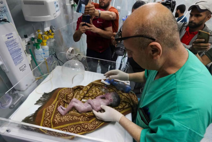 Gaza: des médecins font naître un bébé sauvé du corps mourant de sa mère Gaza: des médecins font naître un bébé sauvé du corps mourant de sa mère