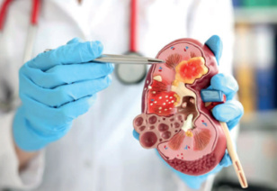 Aïd Al-Adha : Les mille et un bienfaits de la viande ovine Aïd Al-Adha : Les mille et un bienfaits de la viande ovine