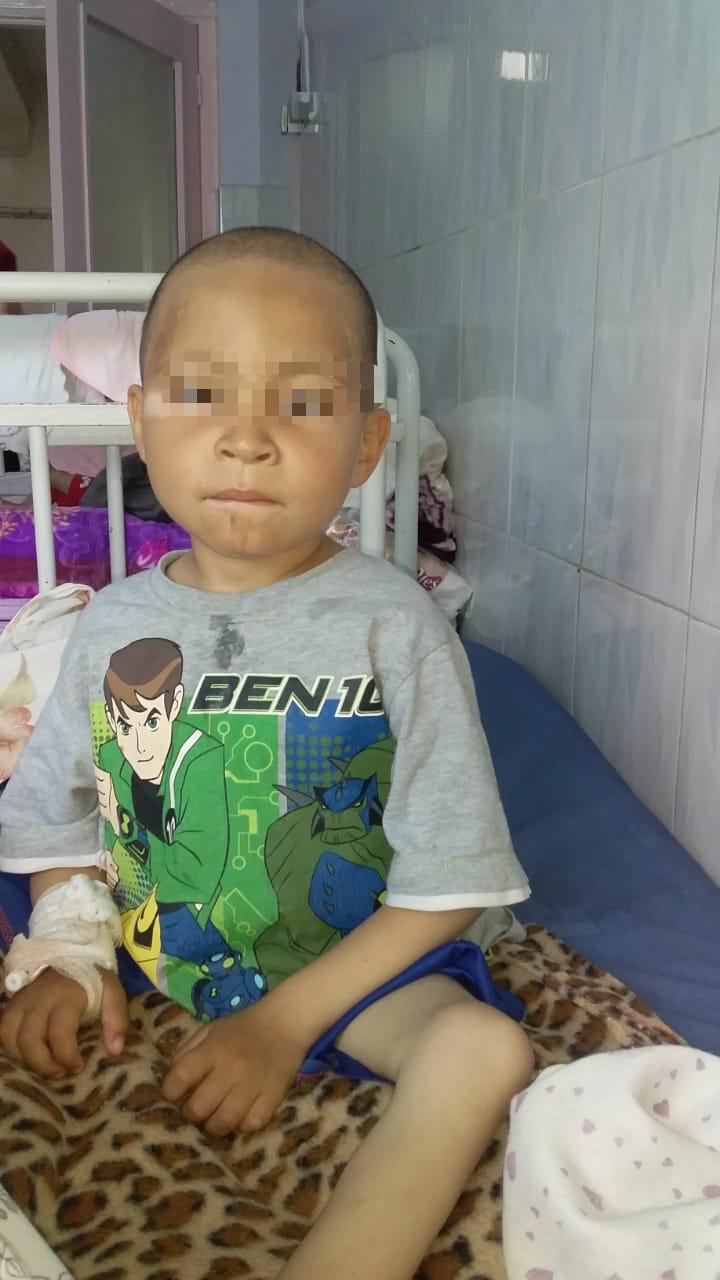 Enfant atteint de la Phénylcétonurie
