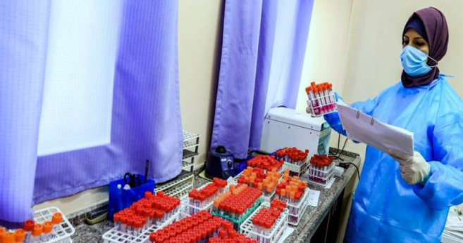 Palestine : Une pénurie de kits de test Covid-19 dans la bande de Gaza Palestine : Une pénurie de kits de test Covid-19 dans la bande de Gaza