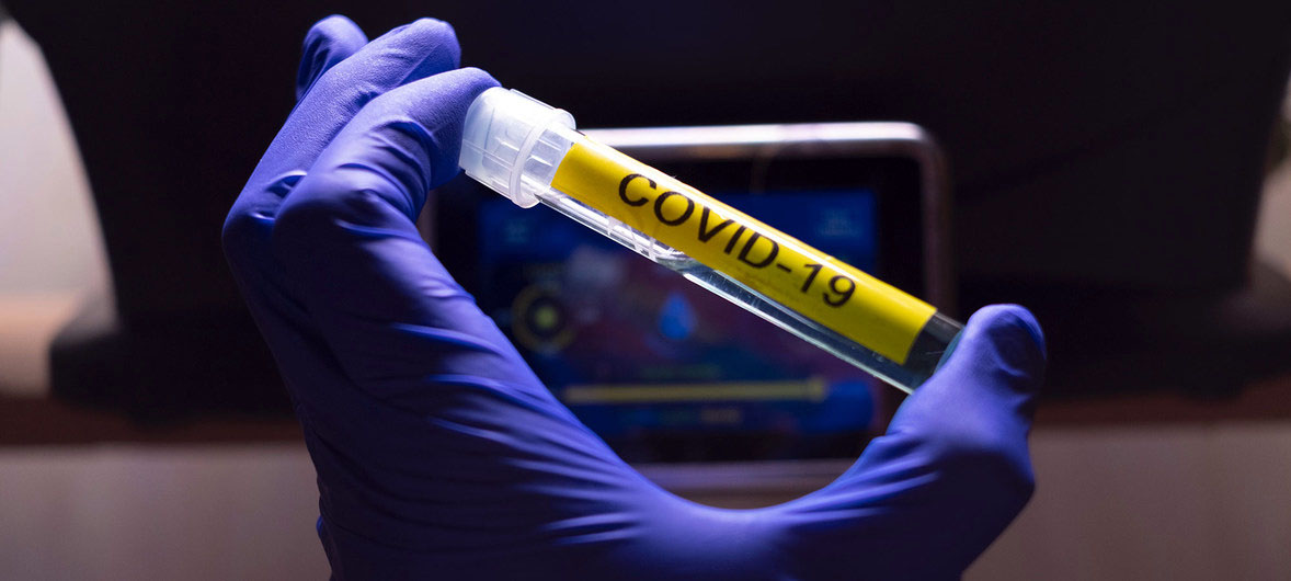  ONU : Le Covid-19 pourrait devenir une maladie saisonnière 