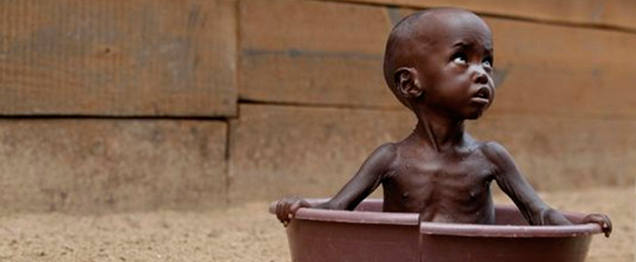 Madagascar : La famine sévit dramatiquement