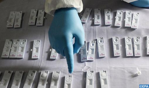 Tests rapides : La tutelle exclut définitivement les pharmacies du dépistage de masse