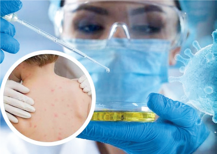 Virologie / Covid-19 : Zoom sur les leçons tirées de la riposte au VIH