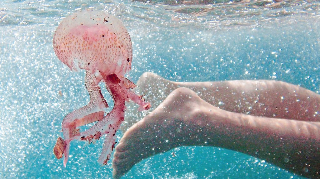 Retour des méduses sur le littoral méditerranéen : voici les bons gestes à  adopter en cas de piqûre 