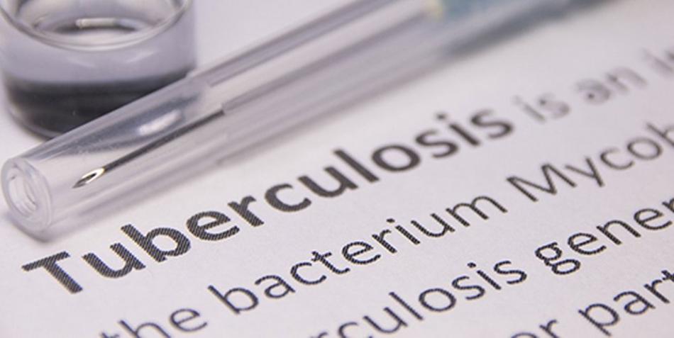 Casablanca : Un nouveau centre dédié au diagnostic de la tuberculose et maladies respiratoires 