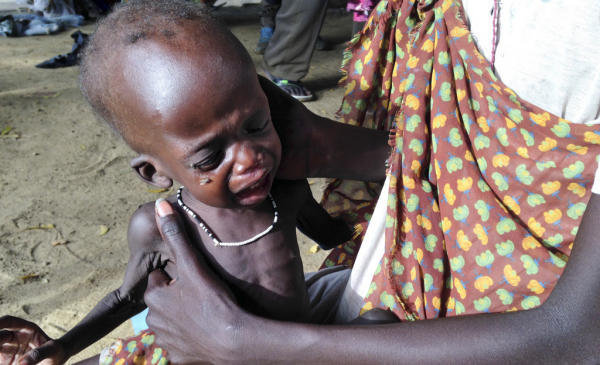 Soudan : Quand la faim fauche l’enfance