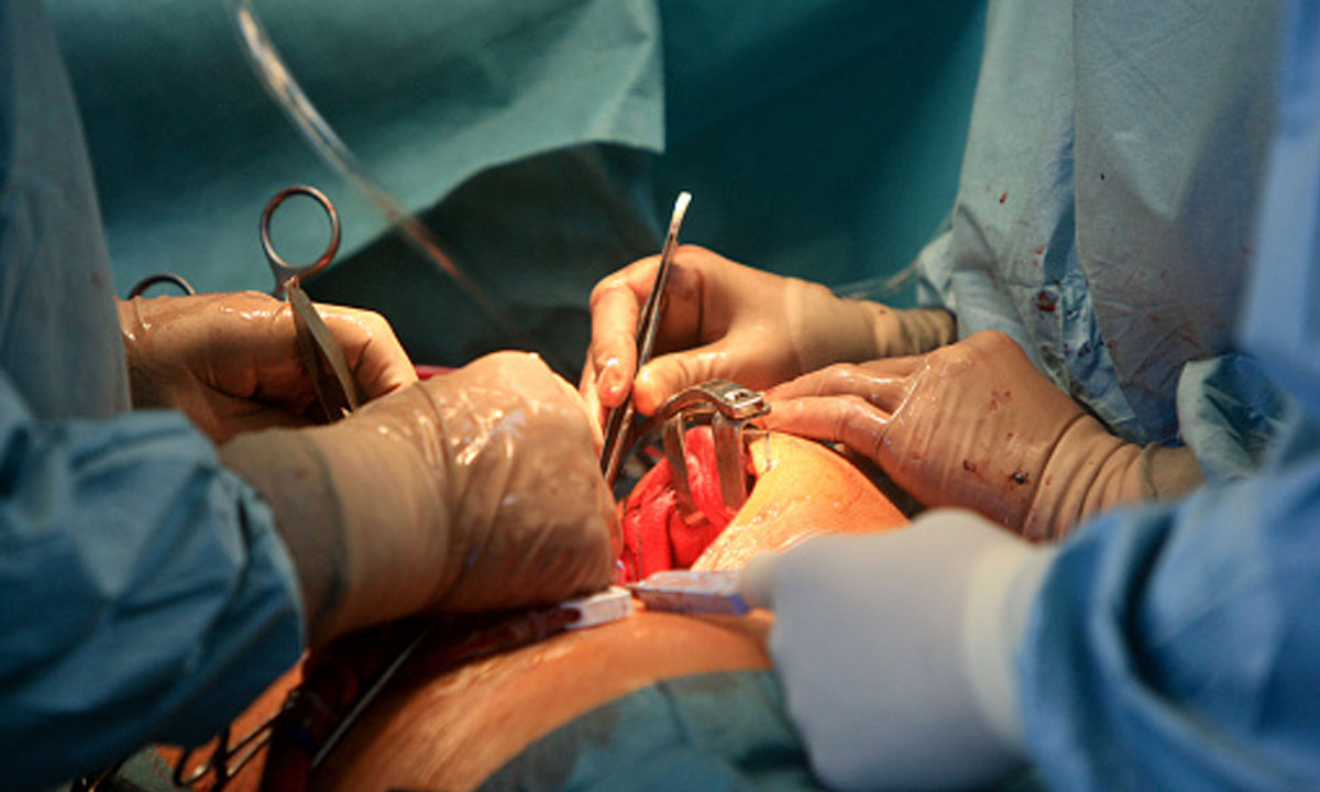 Laâyoune / Hôpital Moulay Hassan Ben Mehdi : Succès de la première opération à cœur ouvert