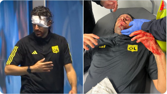 Ligue 1 / OM-OL:  Incidents graves, match non joué! Ligue 1 / OM-OL:  Incidents graves, match non joué!