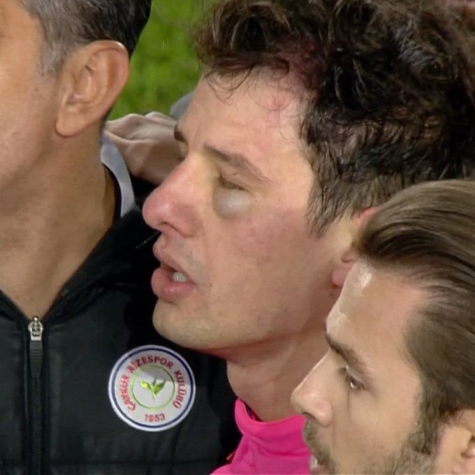 Football /Violence dans les stades turcs : Toutes les compétitions suspendues suite à l’agression d’un arbitre Football /Violence dans les stades turcs : Toutes les compétitions suspendues suite à l’agression d’un arbitre