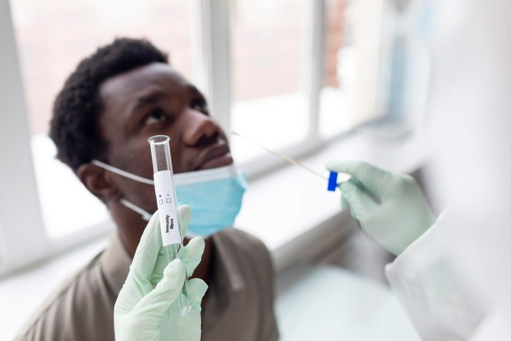 L'Union africaine recommande un test PCR marocain pour détecter la Mpox 