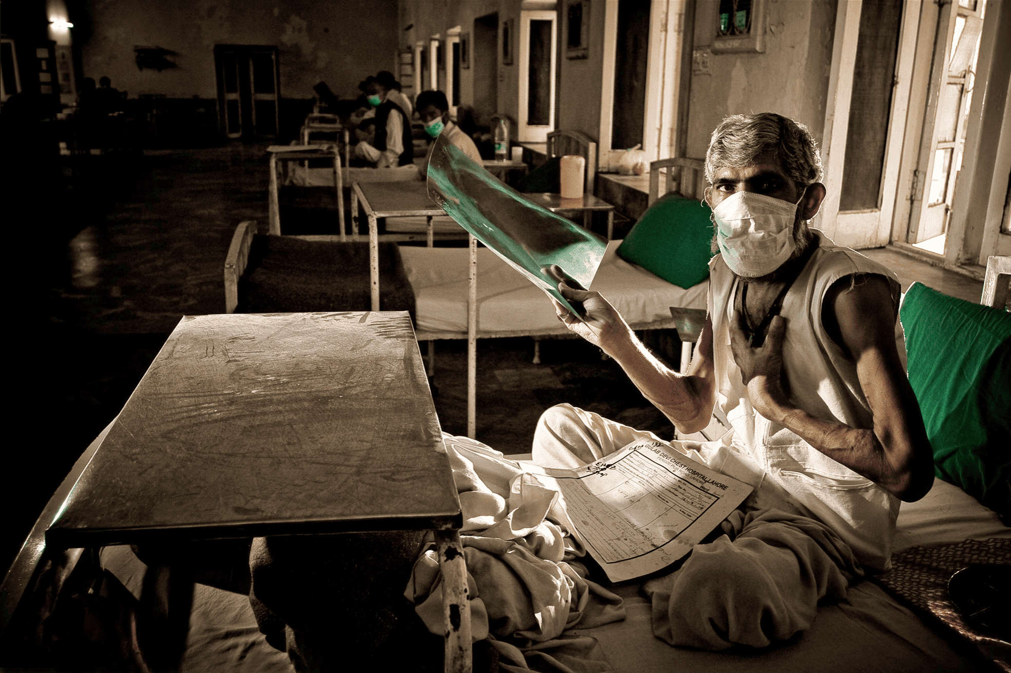 Tuberculose: Plus de 1,2 million de morts en 2024, avertit l'OMS