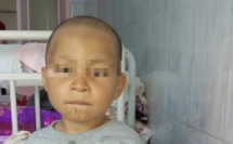 Phénylcétonurie : des enfants meurent de faim à l’ombre de la pandémie