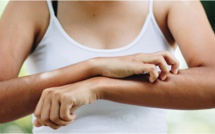 Huiles essentielles, répulsifs, bracelets... Comment se protéger contre les moustiques ?