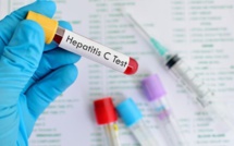 Journée mondiale contre l'hépatite : Une enquête nationale sur la séroprévalence des hépatites virales sera bientôt publiée