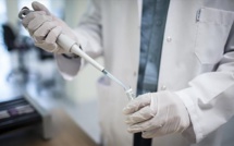 Variole du singe : L'OMS recense 80 cas dans 27 pays