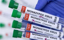 Variole du singe : Alerte maximale à l’OMS