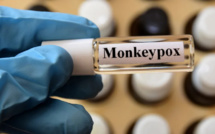 Variole du singe : L'OMS maintient l'alerte sanitaire maximale