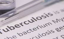Casablanca : Un nouveau centre dédié au diagnostic de la tuberculose et maladies respiratoires 