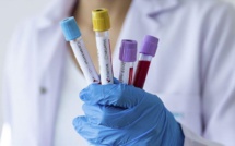Coronavirus : L’OMS annonce une hausse des infections dans le monde