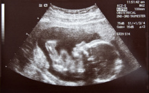 IA : Deepecho révolutionne le diagnostic pré-natal