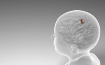 Technologie : Neuralink a posé son premier implant cérébral
