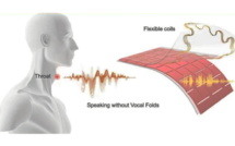 Intelligence Artificielle: Un patch sur la gorge pour parler sans utiliser ses cordes vocales