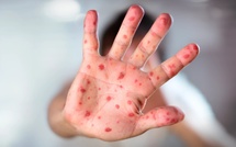 El Jadida - Reportage : Méthodes traditionnelles vs vaccination, un défi sanitaire face à la résurgence des épidémies  !