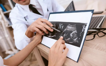 Lancement d'une campagne nationale de communication sur l'importance des soins prénatals